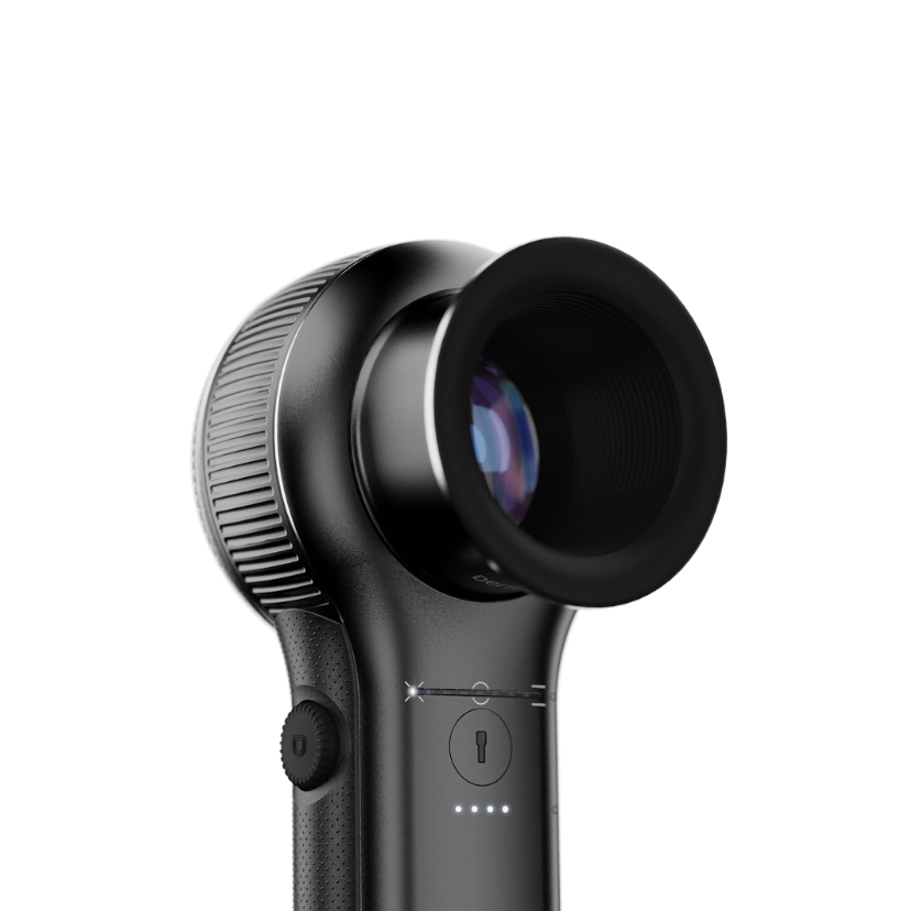 DermLite DL5 - Image 2