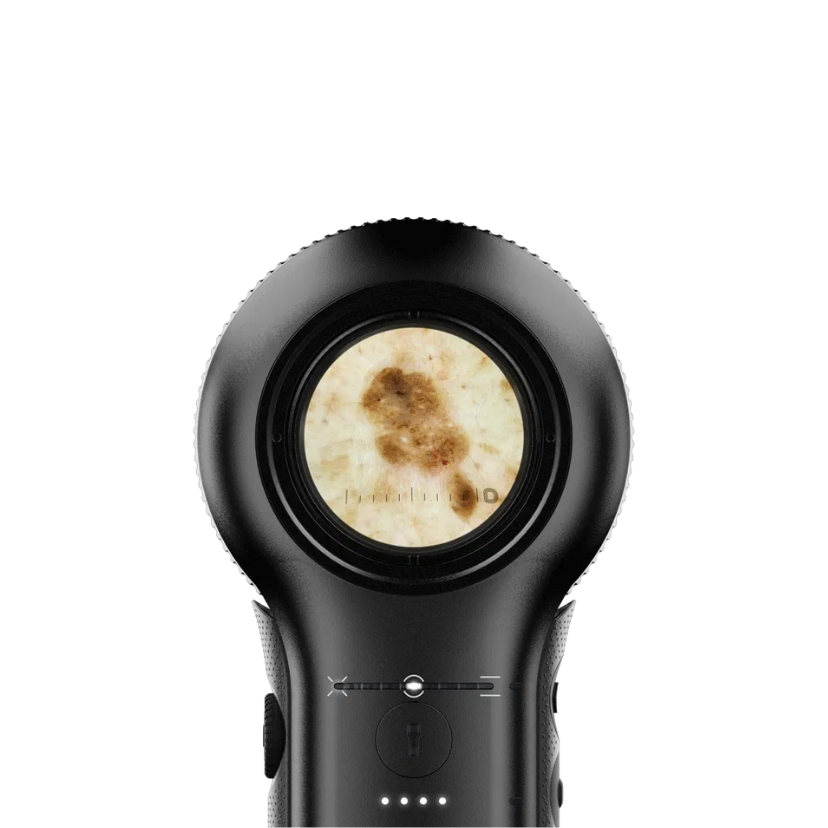 DermLite DL5 - Image 3